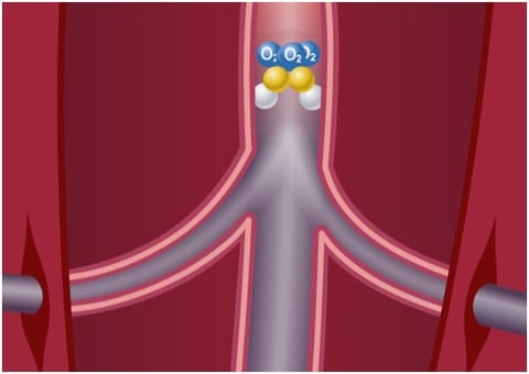 Module 7 : Diabetic Foot Ulcers: Prevention and Management Module 7 : Diabetic Foot Ulcers: Prevention and Management