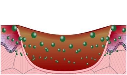 Module 9 : Infection Management Module 9 : Infection Management
