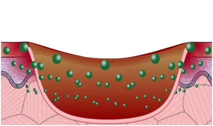 Module 9 : Infection Management Module 9 : Infection Management