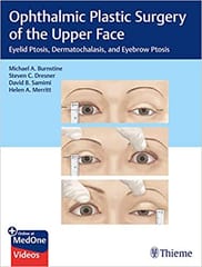 Ophthalmic Plastic Surgery of the Upper Face: Eyelid Ptosis, Dermatochalasis and Eyebrow Ptosis 2019 by Michael Burnstine