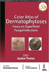 Color Atlas of Fungal Infections 1st Edition 2021 by Jayakar Thomas