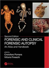 Forensic and Clinical Forensic Autopsy An Atlas and Handbook 2nd Edition 2021 By Cristoforo Pomara