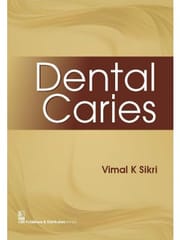 Dental Caries (Pb 2016) By Sikri V.K.