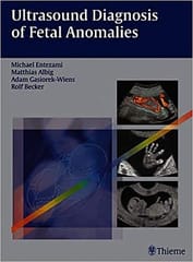 Ultrasound Diagnosis Of Fetal Anomalies By Entezami et al