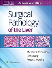 Surgical Pathology Of The Liver By �Michael Torbenson MD