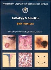 Pathology & Genetics Skin Tumours Who Classification Of Tumours 1st Edition By Leboit