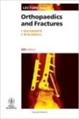 (Ex)Lecture Notes On Orthopaedics And Fractures 3rd Edition By Duckworth