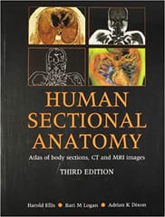 Human Sectional Anatomy Atlas Of Body Sections Ct And Mri Images 3rd Edition By Ellis