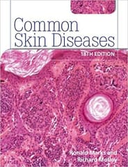 Roxburgh'S Common Skin Diseases(Ie) 18th edition By Marks Motley