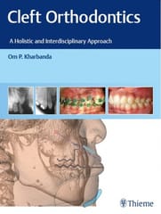 Cleft Orthodontics 1st Edition 2021 By Kharbanda
