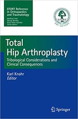 Total Hip Arthroplasty 2013 By Knahr Publisher Springer