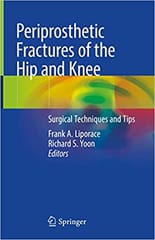Periprosthetic Fractures of the Hip and Knee 2019 By Liporace Publisher Springer