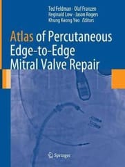 Atlas of Percutaneous Edge-to-Edge Mitral Valve Repair 2013 By Feldman Publisher Springer