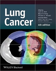 Lung Cancer 4th Edition 2014 By Roth Publisher Wiley