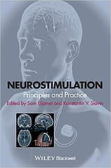 Neurostimulation: Principles and Practice 2013 By Elijamel Publisher Wiley