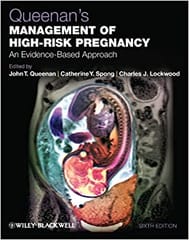 Queenan's Management of High Risk Pregnancy: An Evidence Based Approach 6th Edition 2012 By Queenan Publisher Wiley