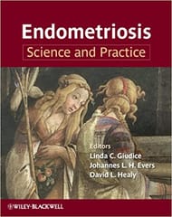 Endometriosis: Science & Practice 2012 By Giudice Publisher Wiley