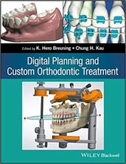 Digital Planning and Custom Orthodontic Treatment 2017 By Breuning Publisher Wiley
