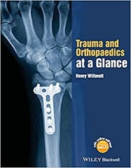 Trauma and Orthopaedics At A Glance 2015 By Willmott Publisher Wiley