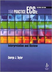 Ex 150 Practice Ecgs Interpretation And Review 2nd Edition 2002 By Taylor