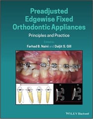 Preadjusted Edgewise Fixed Orthodontic Appliances Principles And Practice 2021 By Naini F B
