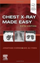 Chest X Ray Made Easy With Access Code 5Ed 2023 By Corne J