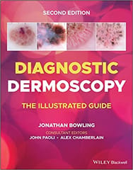 Diagnostic Dermoscopy The Illustrated Guide 2nd Edition 2022 by Jonathan Bowling