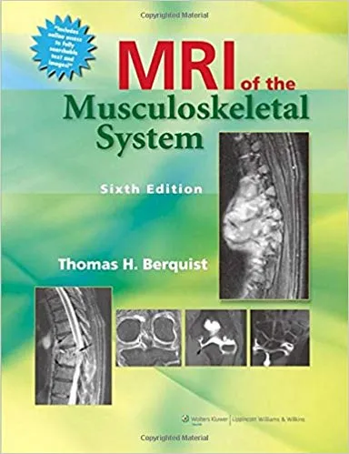 MRI OF THE MUSCULOSKELETAL SYSTEM, 6ED 2013 By BERQUIST