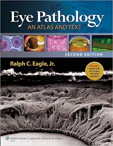 Eye Pathology: An Atlas and Text 2nd Edition By Ralph C. Eagle