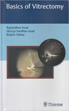 Basics of Vitrectomy 1st Edition By Rajvardhan Azad