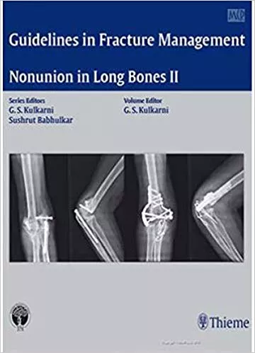 Guidelines in Fracture Management-Nonunion in Long Bones II 2016 By Sushrat Babhulkar