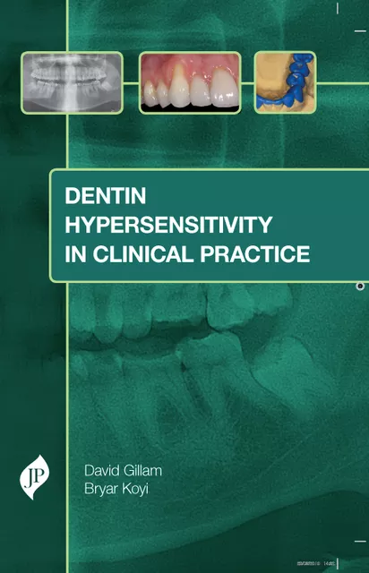 Dentin Hypersensitivity  in Clinical Practice 1st Edition 2020 By David Gillam & Bryar Koyi