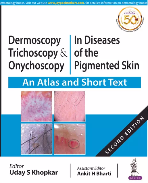 Dermoscopy, Trichoscopy & Onychoscopy  In Diseases of the Pigmented Skin 2nd Edition 2020 By Uday S Khopkar