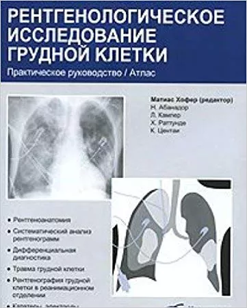 The Chest X-ray A Systematic Teaching Atlas By hofer Abanador Kamper