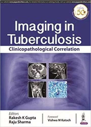 Imaging in Tuberculosis: Clinicopathological Correlation 1st Edition 2019 By Rakesh K Gupta