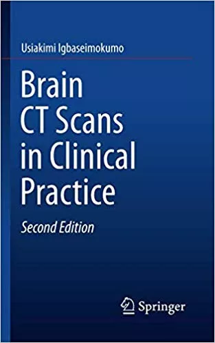 Brain CT Scans in Clinical Practice 2nd Edition 2019 By Usiakimi Igbaseimokumo