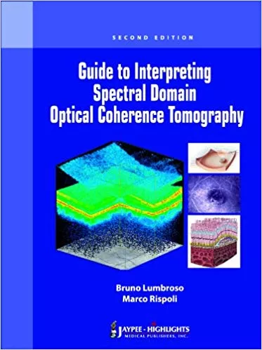 GUIDE TO INTERPRETING SPECTRAL DOMAIN OPTICAL COHERENCE TOMOGRAPHY(PAPERBACK)