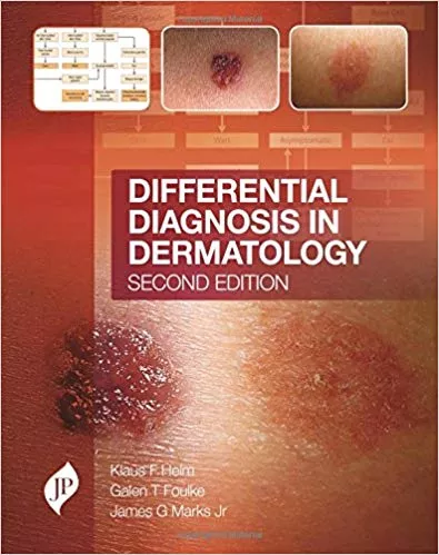 Differential Diagnosis in Dermatology 2017 by Klaus F Helm