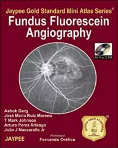 FUNDUS FLUORESCEIN ANGIOGRAPHY JAYPEE GOLD STANDARD MINI ATLAS SERIES WITH PHOTO CD-ROM(PAPERBACK)