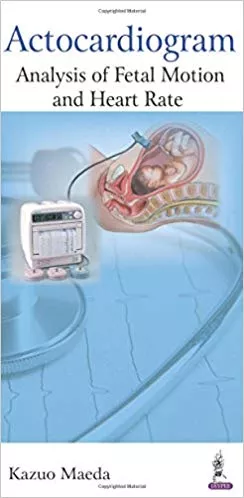 Actocardiogram Analysis Of Fetal Motion And Heart Rate 1st Edition 2016 by Kazuo Maeda