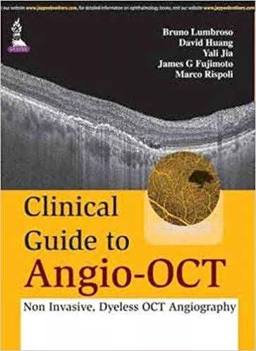 CLINICAL GUIDE TO ANGIO-OCT: NON INVASIVE,DYELESS OCT ANGIOGRAPHY(HARDCOVER)