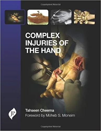 COMPLEX INJURIES OF THE HAND(HARDCOVER)