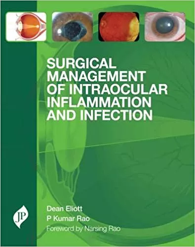SURGICAL MANAGEMENT OF INTRAOCULAR INFLAMMATION AND INFECTION(HARDCOVER)