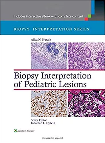 Biopsy Interpretation of Pediatric Lesions (Biopsy Interpretation Series)