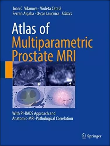 Atlas of Multiparametric Prostate MRI 2018 By Joan C. Vilanova