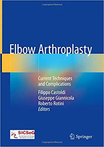 Elbow Arthroplasty: Current Techniques and Complications 2020 By Castoldi