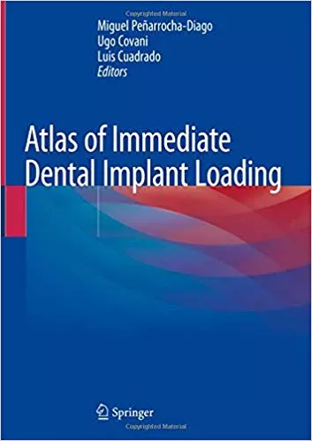Atlas of Immediate Dental Implant Loading 2019 By Miguel Pe��arrocha-Diago