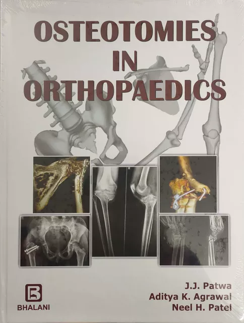Osteotomies In Orthopaedics 2019 By J.J Patwa Aditya K Agrawal And Neel H Patel