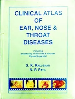 Clinical Atlas Of Ear Nose And Throat Diseases By S.K Kaluskar And N.P Patil