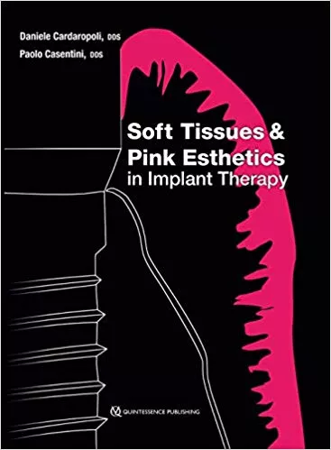 Soft Tissues & Pink Esthetics in Implant Therapy 2020 By Cardaropoli